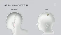 Neuralink არქიტექტურის სქემა — წინა და ახალი ვერსია